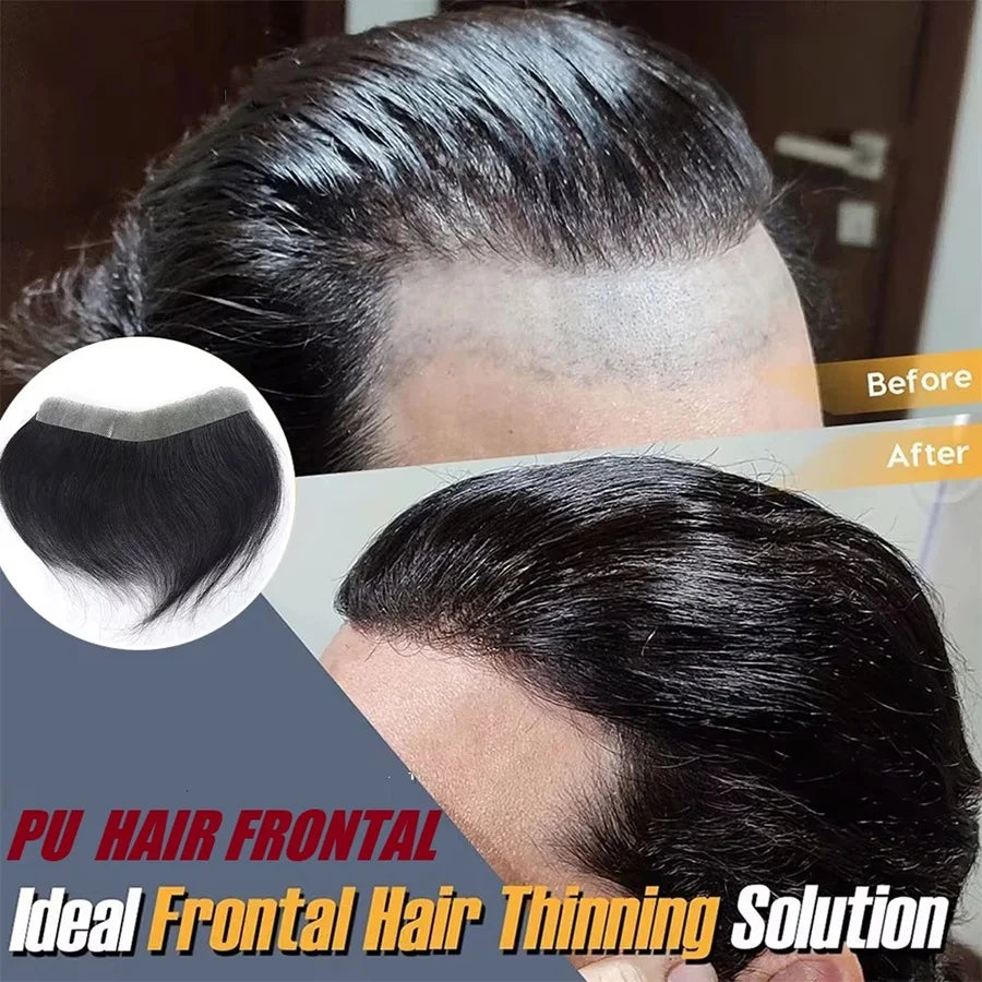 Forehead Hairline Toupee For Men High Density Human Hair Skin PU Mens Frontal Hairpieces Hair Topper Receding Natural Hairline