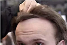 100% Human Hair Toupee With PU Base Hairline For Men Hybrid System Most Realistic Look & Strong Hold For Active Men