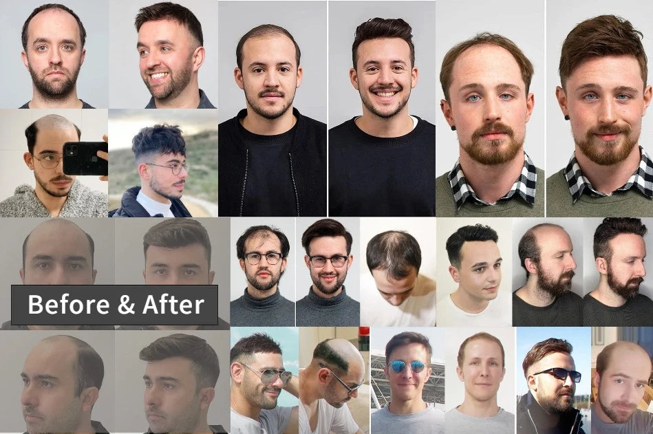 100% Human Hair Toupee With PU Base Hairline For Men Hybrid System Most Realistic Look & Strong Hold For Active Men