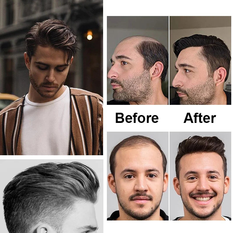 Men Human Hair Toupee Fine Mono NPU Human Hair Wigs Breathable Male Hair Prosthesis Indian Hair System Straight Wave Hairpiece